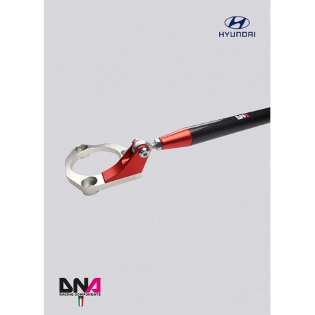 Carbon μπάρα θόλων εμπρός της DNA Racing για Hyundai i20N 2020-2024 (PC2073)